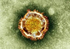 Regno Unito: secondo caso di virus killer simile alla Sars