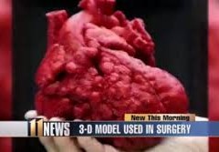 Salvato un bambino grazie a un cuore stampato in 3D